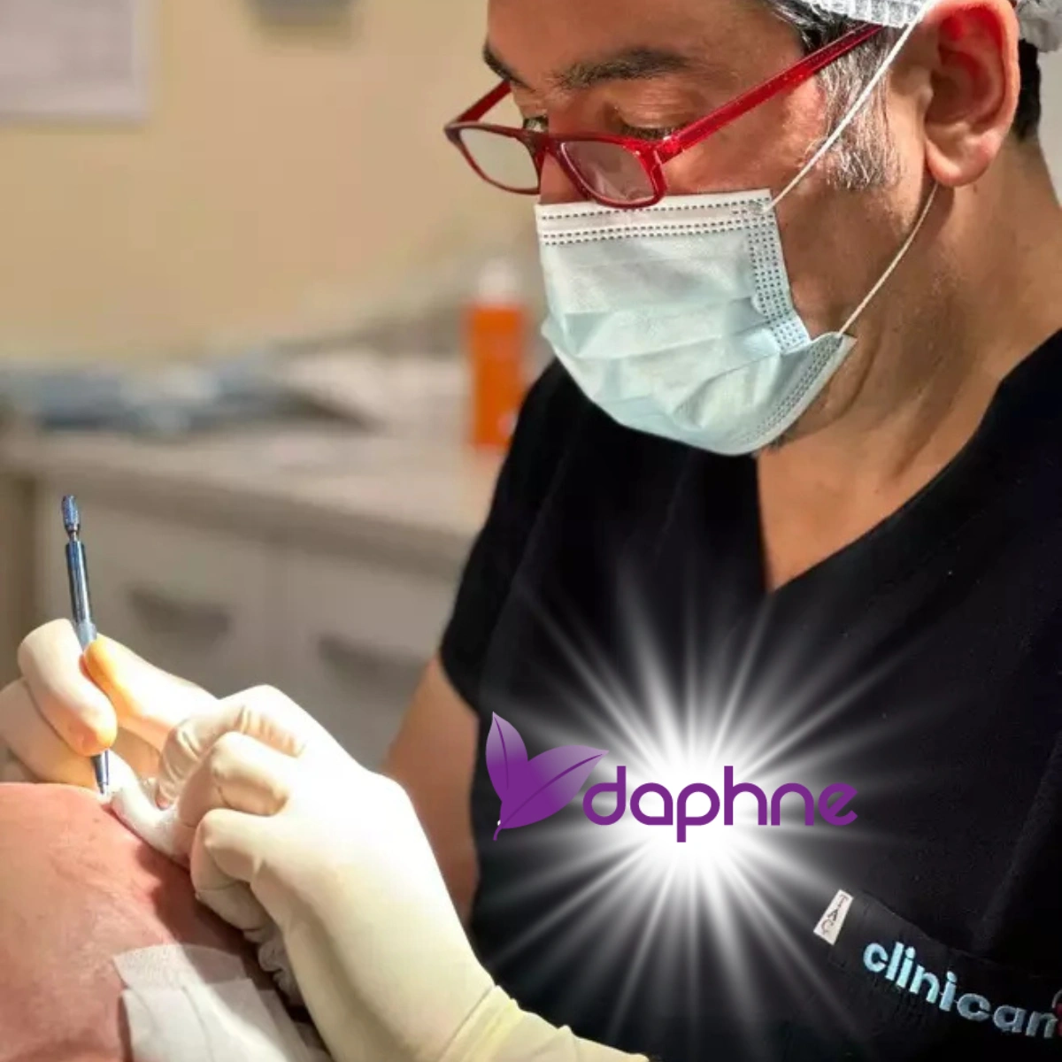 Sapphire FUE трансплантација на коса со Dr. Yakup Şensoy, поединечно земање графтови, сафирни канали и природна линија